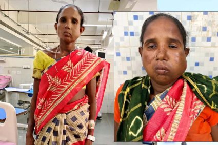 रायपुर: संजीवनी बना मेगा सुपर स्पेशलिटी हेल्थ कैंप, बुधरी मड़कम को मिला नया जीवन